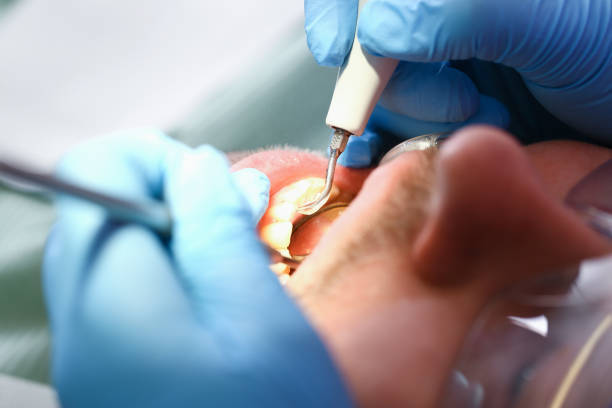 Best Emergency Gum Treatment in Fowlkes, TN